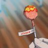 Gastrit